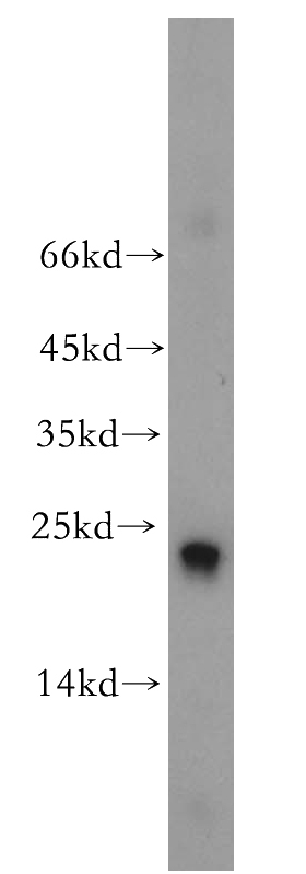 HEK-293 cells were subjected to SDS PAGE followed by western blot with Catalog No:114464(RAB9A-Specific antibody) at dilution of 1:500
