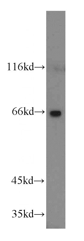 mouse stomach tissue were subjected to SDS PAGE followed by western blot with Catalog No:109671(CCDC86 antibody) at dilution of 1:500