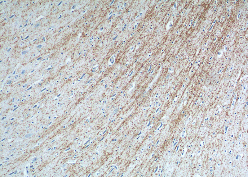 Immunohistochemistry of paraffin-embedded human brain tissue slide using Catalog No:112375(MAG Antibody) at dilution of 1:200 (under 10x lens).