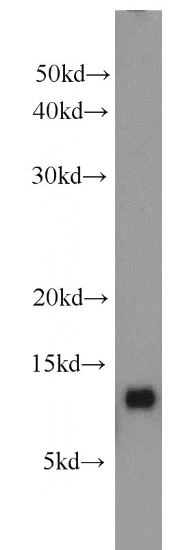 A549 cells were subjected to SDS PAGE followed by western blot with Catalog No:115038(SAA2 antibody) at dilution of 1:1000