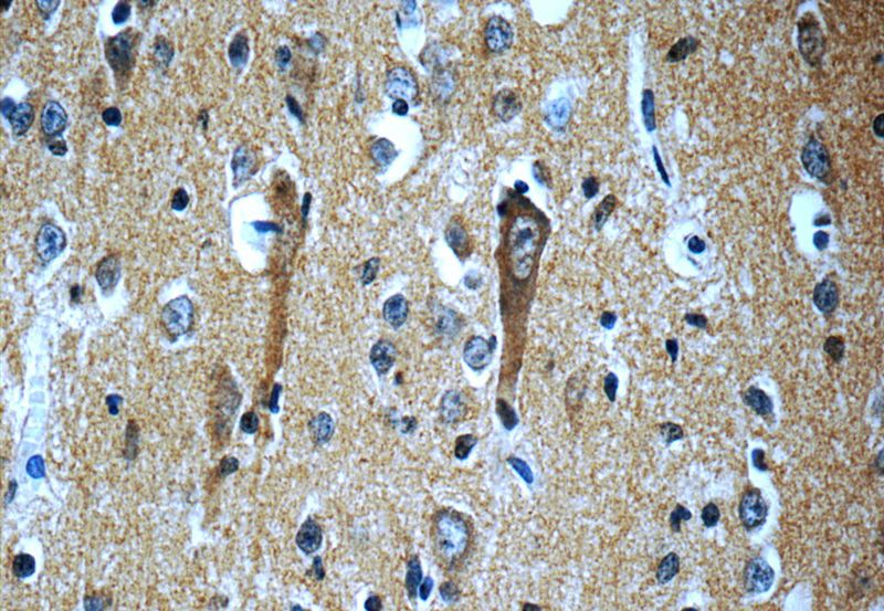 Immunohistochemistry of paraffin-embedded human brain slide using Catalog No:115506(SORL1 Antibody) at dilution of 1:50