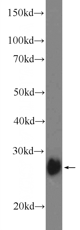 mouse kidney tissue were subjected to SDS PAGE followed by western blot with Catalog No:116266(TPK1 Antibody) at dilution of 1:1000