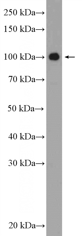Y79 cells were subjected to SDS PAGE followed by western blot with Catalog No:115252(SIX5 Antibody) at dilution of 1:600