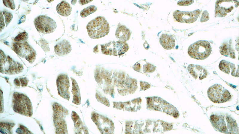 Immunohistochemistry of paraffin-embedded human heart tissue slide using Catalog No:110547(FBXO17 Antibody) at dilution of 1:50 (under 40x lens)