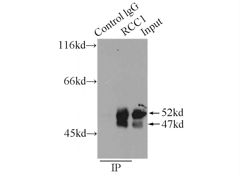 IP Result of anti-RCC1 (IP:Catalog No:114577, 3ug; Detection:Catalog No:114577 1:1000) with HEK-293 cells lysate 1000ug.