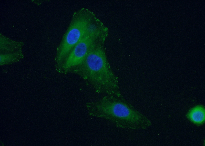 Immunofluorescent analysis of (10% Formaldehyde) fixed A549 cells using Catalog No:107202(FAK Antibody) at dilution of 1:100 and Alexa Fluor 488-congugated AffiniPure Goat Anti-Mouse IgG(H+L)