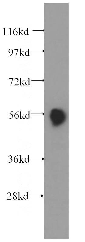 human pancreas tissue were subjected to SDS PAGE followed by western blot with Catalog No:113568(PNLIP antibody) at dilution of 1:500