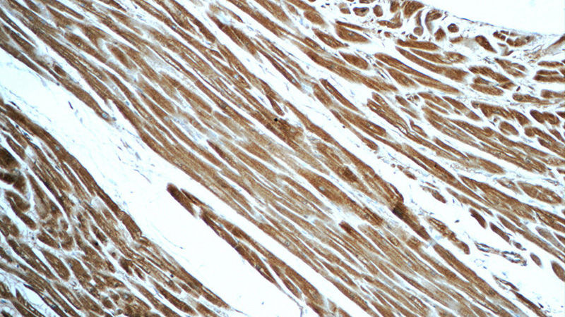 Immunohistochemistry of paraffin-embedded human heart tissue slide using Catalog No:112548(MCHR1 Antibody) at dilution of 1:50 (under 10x lens)