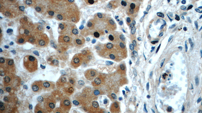 Immunohistochemistry of paraffin-embedded human liver slide using Catalog No:107303(GOSR2 Antibody) at dilution of 1:50