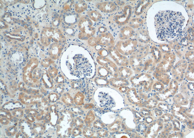 Immunohistochemistry of paraffin-embedded human kidney tissue slide using Catalog No:116777(VPS26A Antibody) at dilution of 1:200 (under 10x lens).