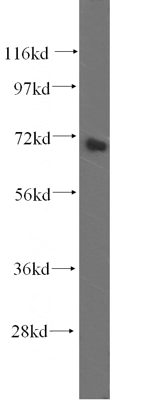 human skeletal muscle tissue were subjected to SDS PAGE followed by western blot with Catalog No:111214(GRK5 antibody) at dilution of 1:400