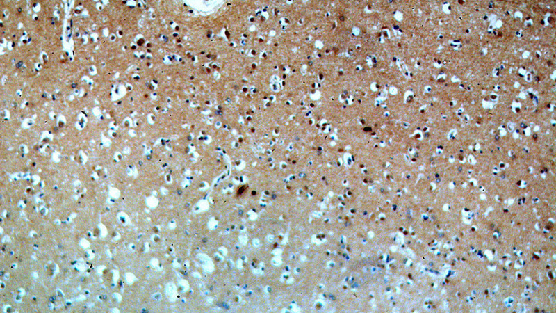 Immunohistochemical of paraffin-embedded human brain using Catalog No:109396(CLN3 antibody) at dilution of 1:50 (under 10x lens)
