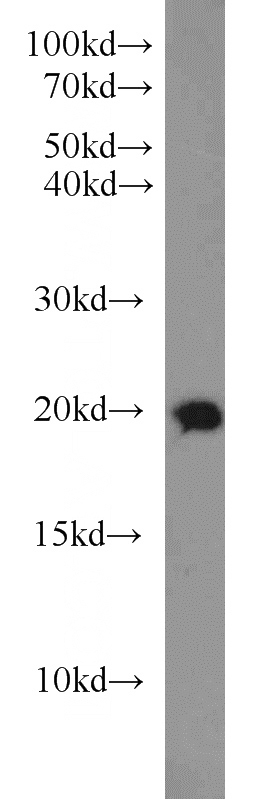human testis tissue were subjected to SDS PAGE followed by western blot with Catalog No:114415(RAB18 antibody) at dilution of 1:800