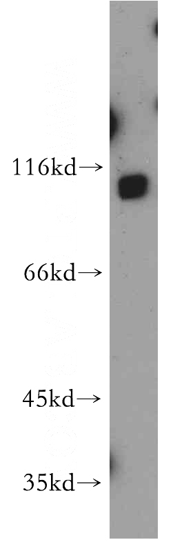 A549 cells were subjected to SDS PAGE followed by western blot with Catalog No:115360(SLITRK6 antibody) at dilution of 1:500