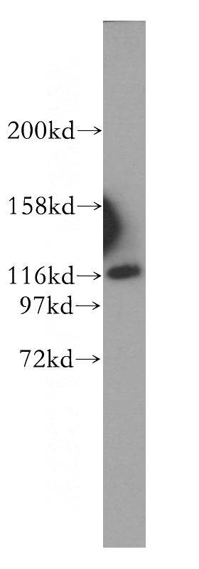 HeLa cells were subjected to SDS PAGE followed by western blot with Catalog No:111820(IPO4 antibody) at dilution of 1:500