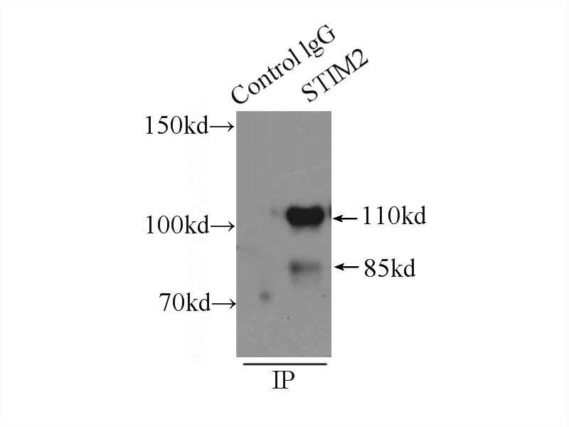 IP Result of anti-STIM2 (IP:Catalog No:115708, 3ug; Detection:Catalog No:115708 1:500) with HEK-293 cells lysate 2000ug.