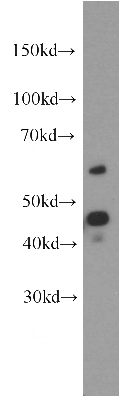 HeLa cells were subjected to SDS PAGE followed by western blot with Catalog No:109686(CYP20A1 antibody) at dilution of 1:2000