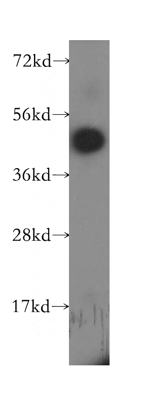 K-562 cells were subjected to SDS PAGE followed by western blot with Catalog No:112865(MS4A6A antibody) at dilution of 1:400