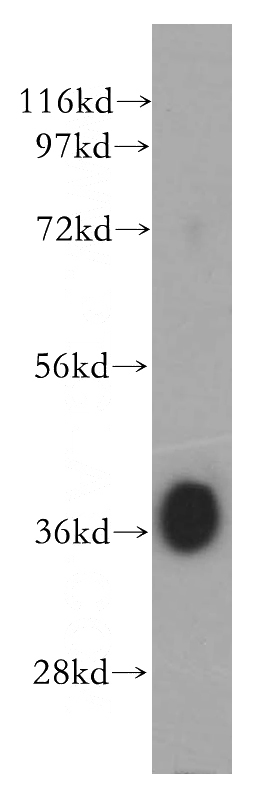 mouse spermatophore tissue were subjected to SDS PAGE followed by western blot with Catalog No:110002(DMC1 antibody) at dilution of 1:1000
