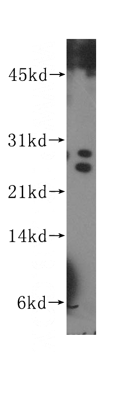 K-562 cells were subjected to SDS PAGE followed by western blot with Catalog No:111523(PSMC3IP antibody) at dilution of 1:500