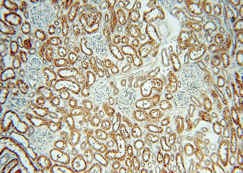 Immunohistochemical of paraffin-embedded human kidney using Catalog No:108876(CASP3 antibody) at dilution of 1:50 (under 10x lens)
