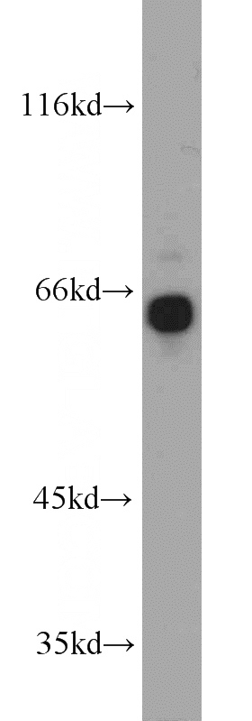 A431 cells were subjected to SDS PAGE followed by western blot with Catalog No:111201(GRB7 antibody) at dilution of 1:1000