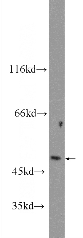 mouse thymus tissue were subjected to SDS PAGE followed by western blot with Catalog No:116304(TRIM22 Antibody) at dilution of 1:300