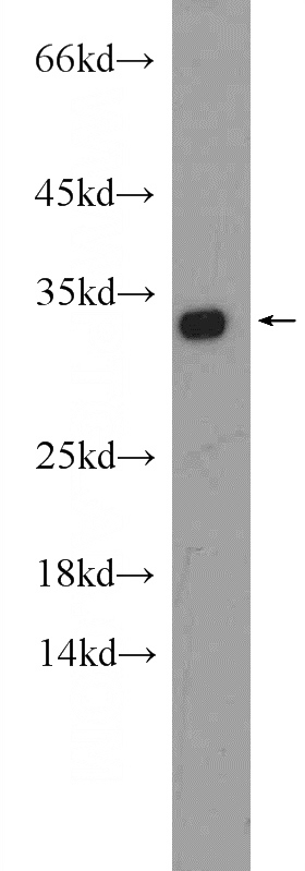 HeLa cells were subjected to SDS PAGE followed by western blot with Catalog No:111263(HAX1 Antibody) at dilution of 1:300