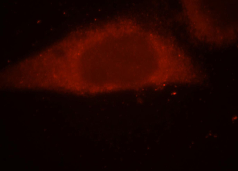 Immunofluorescent analysis of HepG2 cells, using SRP54 antibody Catalog No:115593 at 1:25 dilution and Rhodamine-labeled goat anti-rabbit IgG (red).