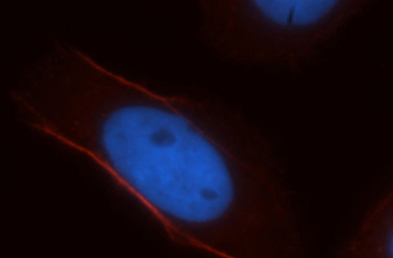 Immunofluorescent analysis of Hela cells, using CNN3 antibody Catalog No:109428 at 1:25 dilution and Rhodamine-labeled goat anti-rabbit IgG (red). Blue pseudocolor = DAPI (fluorescent DNA dye).