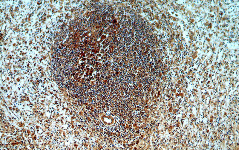 Immunohistochemical of paraffin-embedded human spleen using Catalog No:108935(CAPG-Specific antibody) at dilution of 1:50 (under 10x lens)