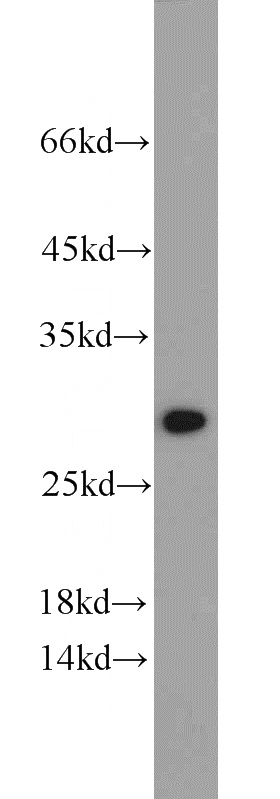 HEK-293 cells were subjected to SDS PAGE followed by western blot with Catalog No:108105(ANP32B antibody) at dilution of 1:1000