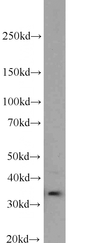 Jurkat cells were subjected to SDS PAGE followed by western blot with Catalog No:108878(CASP6 antibody) at dilution of 1:800