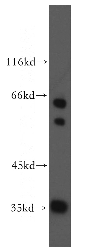 COLO 320 cells were subjected to SDS PAGE followed by western blot with Catalog No:115475(SNX20 antibody) at dilution of 1:300