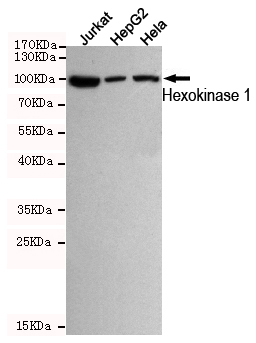 Western blot detection of Hexokinase 1 in Jurkat,HepG2 and Hela cell lysates using Hexokinase 1 mouse mAb (dilution 1:500).Predicted band size:102KDa.Observed band size:102KDa.