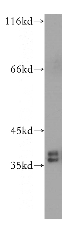 HL-60 cells were subjected to SDS PAGE followed by western blot with Catalog No:111501(HNRNPA2B1 antibody) at dilution of 1:400