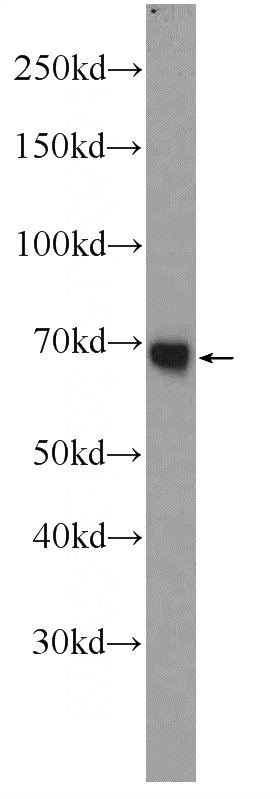 human plasma tissue were subjected to SDS PAGE followed by western blot with Catalog No:113786(PGLYRP2 Antibody) at dilution of 1:1000