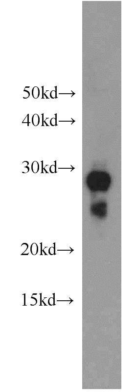 mouse thymus tissue were subjected to SDS PAGE followed by western blot with Catalog No:111365(HIST1H1A antibody) at dilution of 1:1000