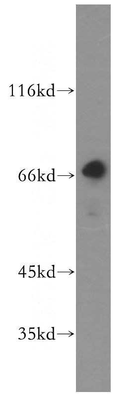 HEK-293 cells were subjected to SDS PAGE followed by western blot with Catalog No:112097(KLHL20 antibody) at dilution of 1:500