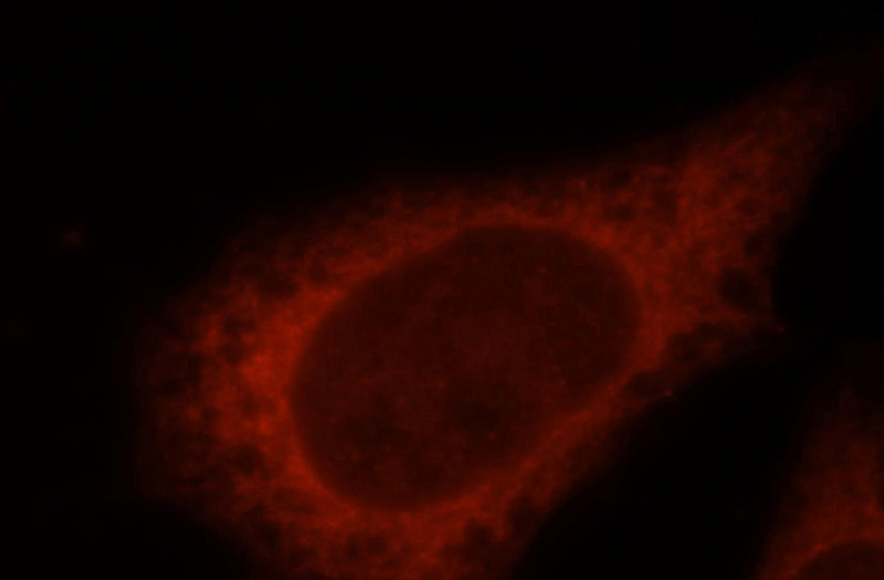 Immunofluorescent analysis of MCF-7 cells, using DTYMK antibody Catalog No:110041 at 1:25 dilution and Rhodamine-labeled goat anti-rabbit IgG (red).