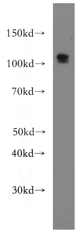 HEK-293 cells were subjected to SDS PAGE followed by western blot with Catalog No:110151(DZIP1 antibody) at dilution of 1:300