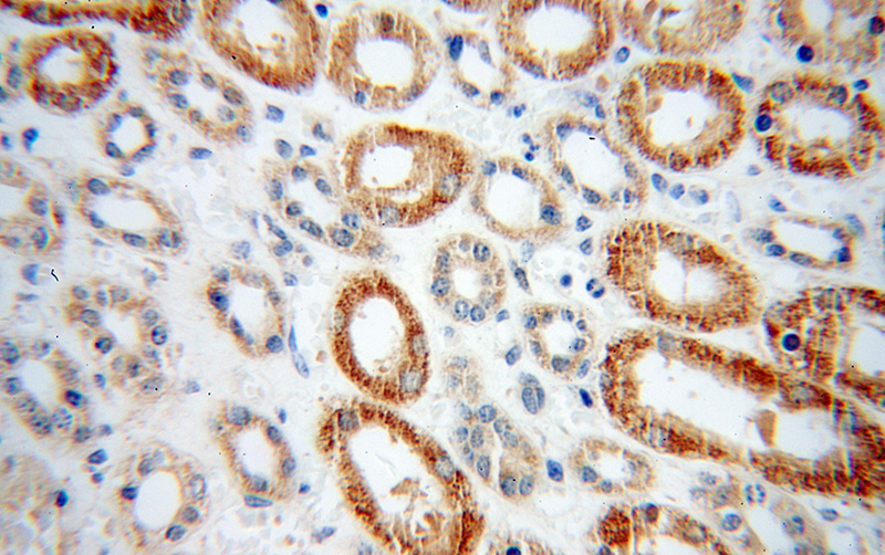 Immunohistochemical of paraffin-embedded human kidney using Catalog No:113864(PHYH antibody) at dilution of 1:50 (under 40x lens)
