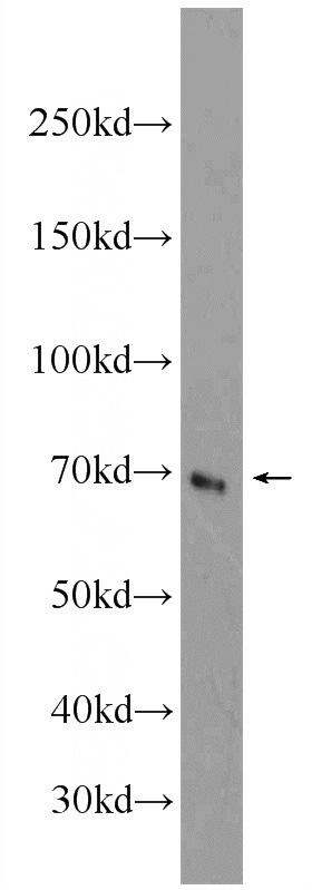 HeLa cells were subjected to SDS PAGE followed by western blot with Catalog No:109309(BIRC3 Antibody) at dilution of 1:600