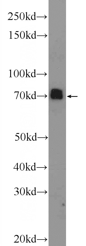mouse brain tissue were subjected to SDS PAGE followed by western blot with Catalog No:115763(SYN1-Specific Antibody) at dilution of 1:5000