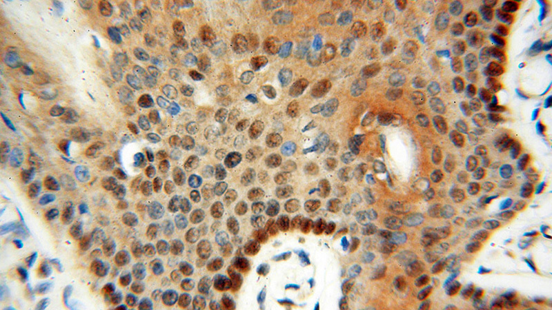 Immunohistochemical of paraffin-embedded human skin using Catalog No:112357(LTA4H antibody) at dilution of 1:100 (under 40x lens)