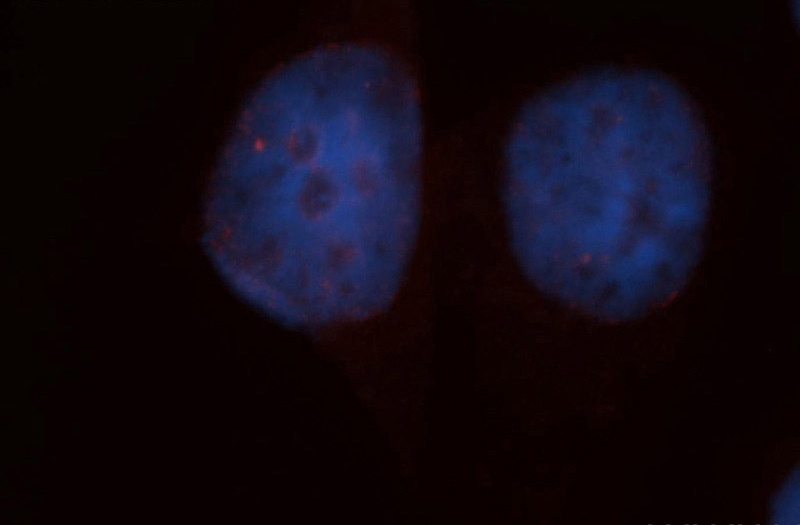 Immunofluorescent analysis of HepG2 cells, using Catalog No:117193 and Rhodamine-labeled goat anti-rabbit IgG (red). Blue pseudocolor = DAPI (fluorescent DNA dye).