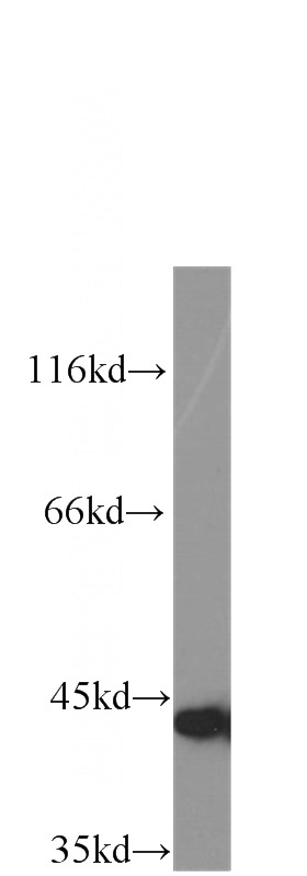 HepG2 cells were subjected to SDS PAGE followed by western blot with Catalog No:107287(CSE antibody) at dilution of 1:1000