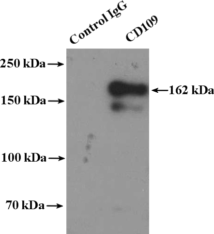 IP Result of anti-CD109 (IP:Catalog No:109040, 4ug; Detection:Catalog No:109040 1:600) with PC-3 cells lysate 5000ug.
