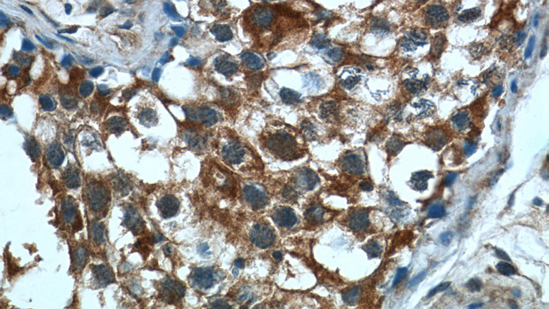 Immunohistochemistry of paraffin-embedded human testis tissue slide using Catalog No:114338(PUMA Antibody) at dilution of 1:200 (under 40x lens)