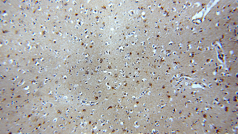 Immunohistochemical of paraffin-embedded human brain using Catalog No:113561(NGFR antibody) at dilution of 1:50 (under 10x lens)